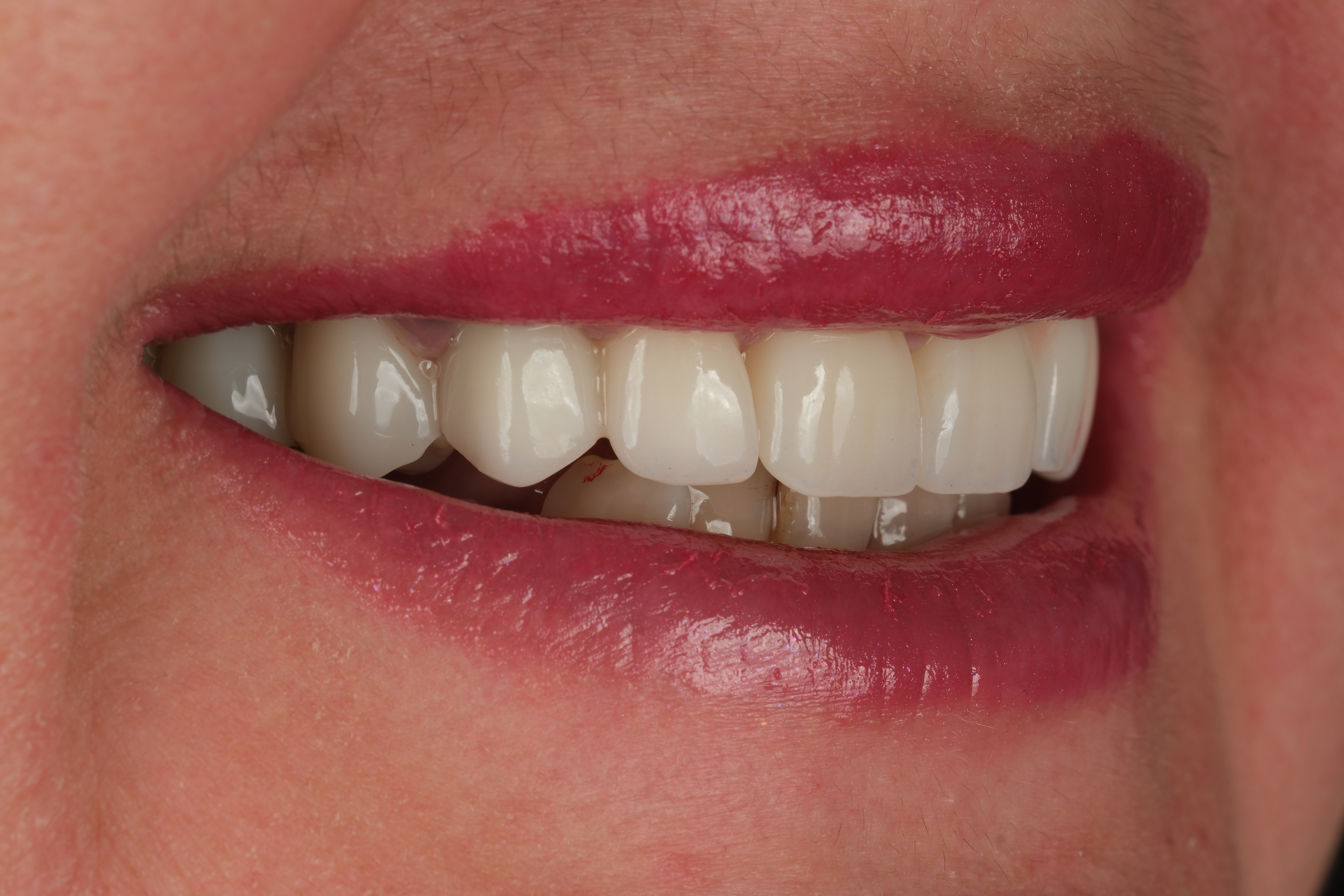 Simena Dental Clinic gallery photo 6